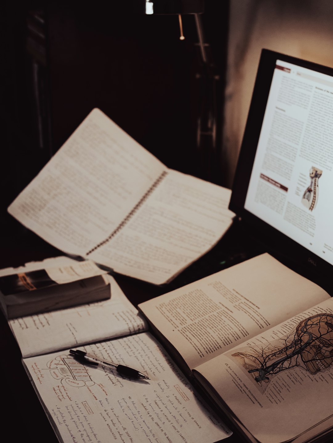 A cluttered desk with textbooks and a laptop showing anatomy.